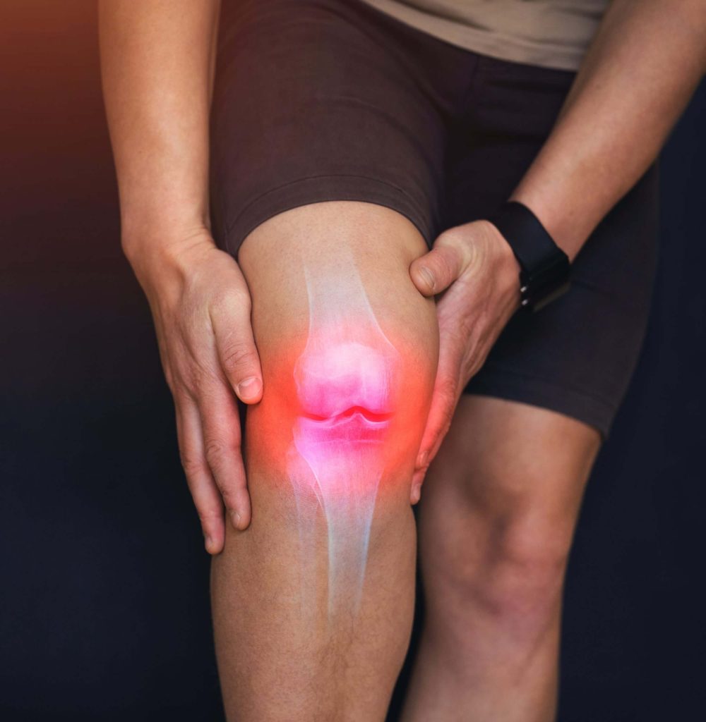 Knee treatment Dr. Paul Macnamara in Dubai - https://drpaulmacnamara.com/