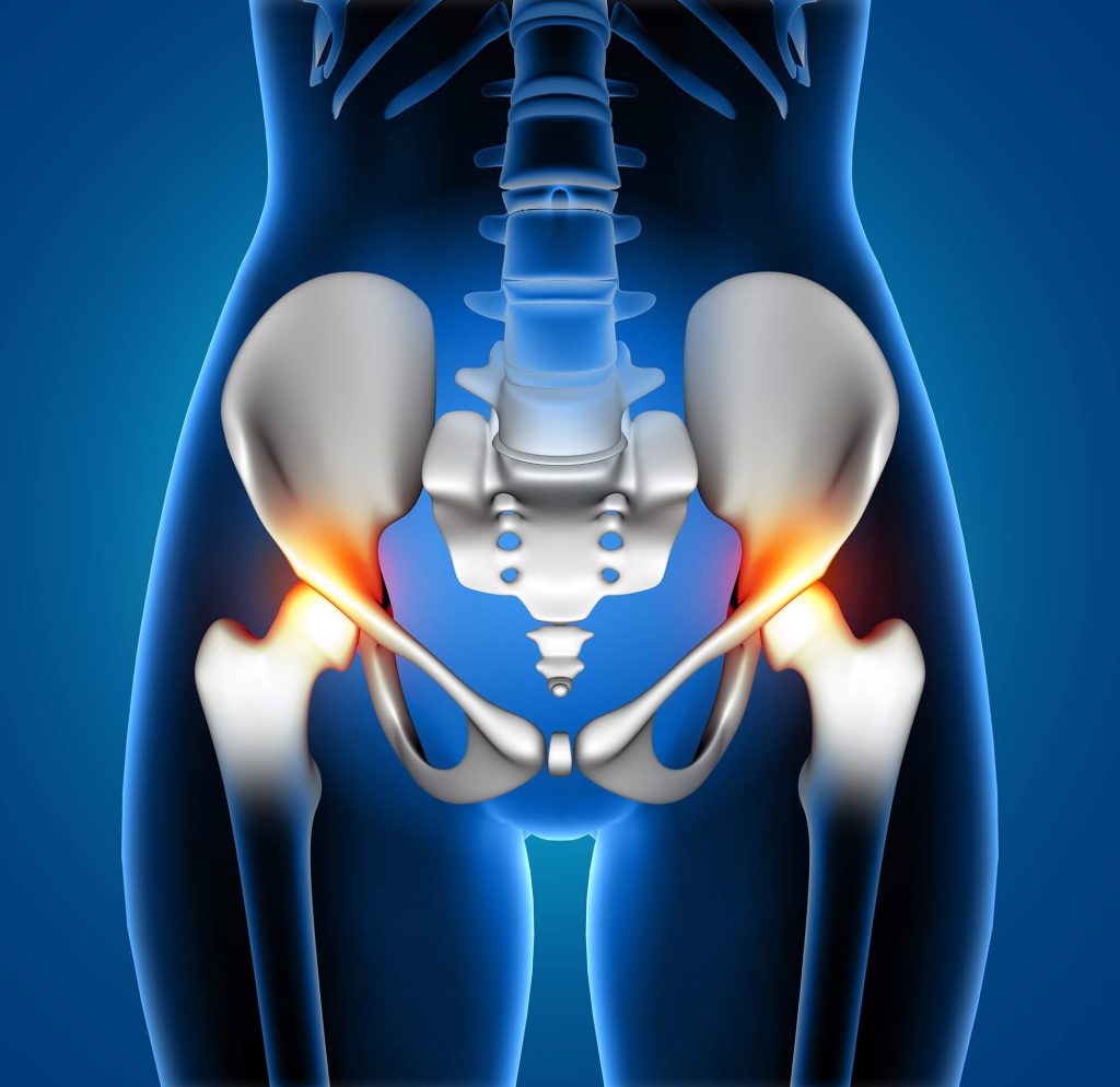 3d female medical figure with spine highlighted pain | Dr. Paul Macnamara consulting a knee replacement patient in Dubai
