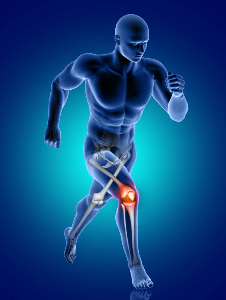 ACL Surgery- Dr. Paul Macnamara -https://drpaulmacnamara.com/
