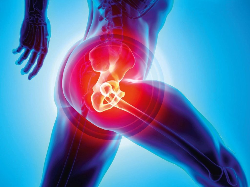 Hip replacement surgery | Dr. Paul Macnamara consulting a knee replacement patient in Dubai