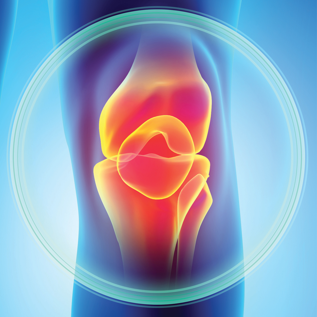 Knee painful abstract 592655170 web | Dr. Paul Macnamara consulting a knee replacement patient in Dubai