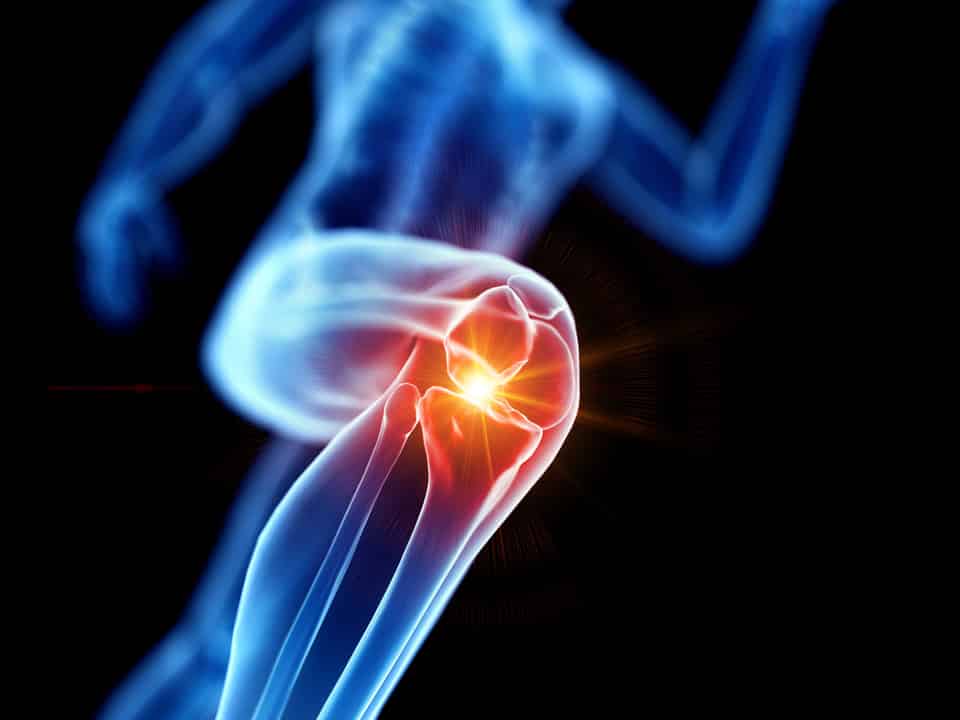 adobestock 253175356 1 | Dr. Paul Macnamara consulting a knee replacement patient in Dubai