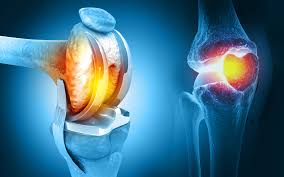 images | Dr. Paul Macnamara consulting a knee replacement patient in Dubai